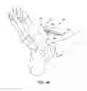 Fig. 45 - Ankle replacement system and method