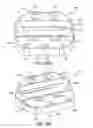 Fig. 54 - Ankle replacement system and method
