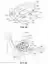 Fig. 57 - Ankle replacement system and method