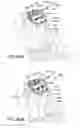 Fig. 59 - Ankle replacement system and method