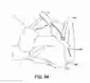 Fig. 61 - Ankle replacement system and method