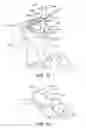 Fig. 68 - Ankle replacement system and method