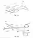 Fig. 69 - Ankle replacement system and method