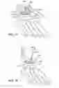Fig. 70 - Ankle replacement system and method