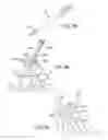 Fig. 71 - Ankle replacement system and method
