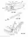 Fig. 74 - Ankle replacement system and method