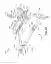 Fig. 75 - Ankle replacement system and method