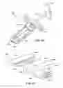 Fig. 76 - Ankle replacement system and method