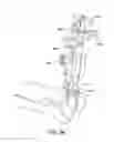 Fig. 79 - Ankle replacement system and method