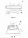 Fig. 82 - Ankle replacement system and method