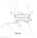 Fig. 83 - Ankle replacement system and method