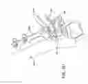 Fig. 85 - Ankle replacement system and method