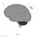 Fig. 02 - End effector joystick for a positioning device