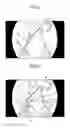 Fig. 04 - Endoscope device