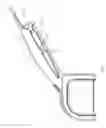 Fig. 04 - Hybrid dental device