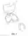 Fig. 02 - Intraoral device holder