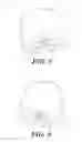 Fig. 03 - Intraoral device holder