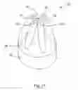Fig. 07 - Kit of parts including a urological device
