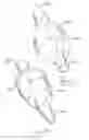 Fig. 10 - Kit of parts including a urological device
