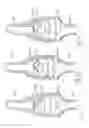 Fig. 15 - Kit of parts including a urological device