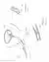 Fig. 25 - Kit of parts including a urological device