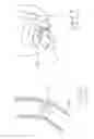 Fig. 27 - Kit of parts including a urological device
