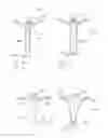 Fig. 33 - Kit of parts including a urological device