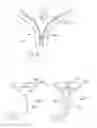Fig. 34 - Kit of parts including a urological device