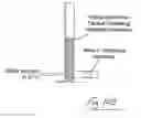 Fig. 47 - Kit of parts including a urological device