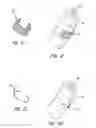 Fig. 09 - Partial cuff
