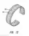 Fig. 10 - Partial cuff