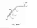 Fig. 06 - Insertion device for delivery of a mesh carrier