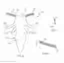 Fig. 04 - Devices and methods for treating pelvic floor dysfunctions
