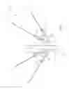 Fig. 07 - Devices and methods for treating pelvic floor dysfunctions