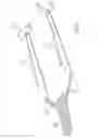 Fig. 49 - Devices and methods for treating pelvic floor dysfunctions