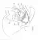 Fig. 56 - Devices and methods for treating pelvic floor dysfunctions
