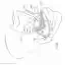 Fig. 57 - Devices and methods for treating pelvic floor dysfunctions