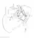 Fig. 59 - Devices and methods for treating pelvic floor dysfunctions