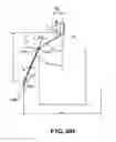 Fig. 06 - Removable embolus blood clot filter