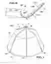 Fig. 10 - Removable embolus blood clot filter