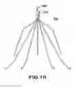 Fig. 13 - Removable embolus blood clot filter