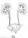 Fig. 02 - Ureteral stent and method