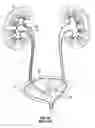 Fig. 03 - Ureteral stent and method