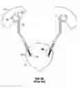 Fig. 05 - Ureteral stent and method