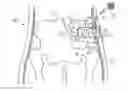 Fig. 01 - Apparatus for controlling flow in a bodily organ