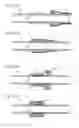 Fig. 112 - Apparatus for controlling flow in a bodily organ