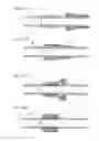 Fig. 120 - Apparatus for controlling flow in a bodily organ