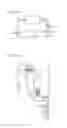 Fig. 125 - Apparatus for controlling flow in a bodily organ