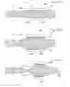 Fig. 150 - Apparatus for controlling flow in a bodily organ
