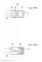 Fig. 155 - Apparatus for controlling flow in a bodily organ